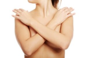 Breast Implant Scars